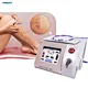 surgical vein ablation